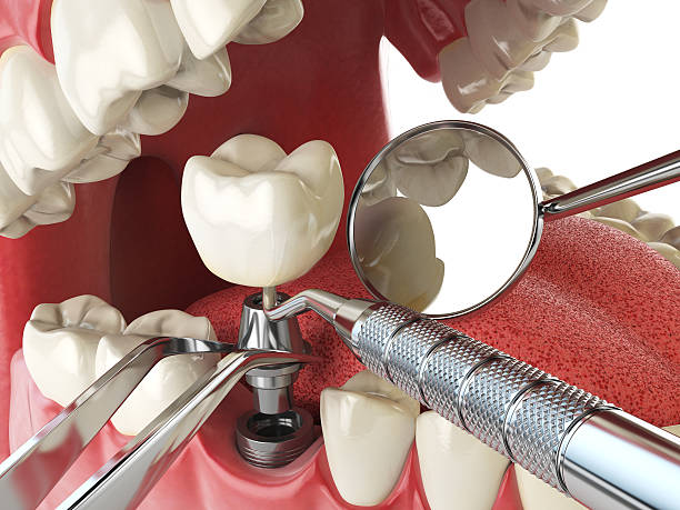 Trusted AL Emergency Dental Service Experts